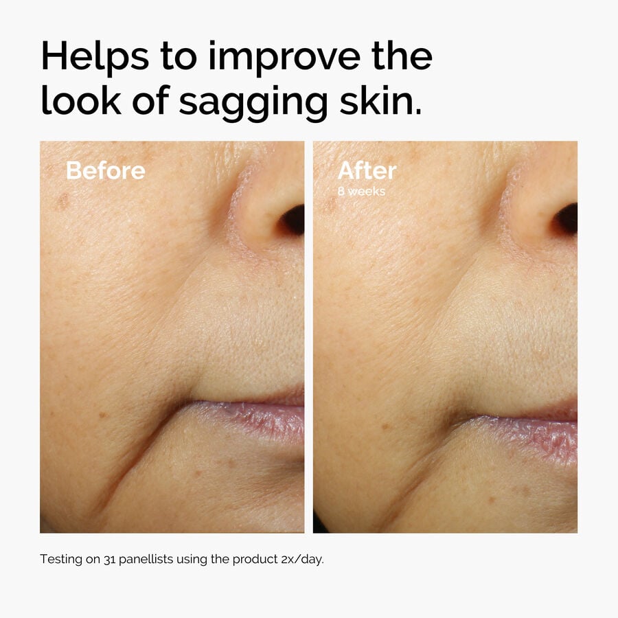 caffeine-3-escin-1-face-serum-v1 ord-caffeine-3pct-escin-1pct-face-serum-before-after-sagging.jpg