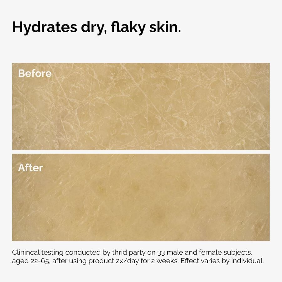 the-body-care-collection-z4 ord-natural-moisturizing-factors-inulin-body-before-after-graphic-02.jpg