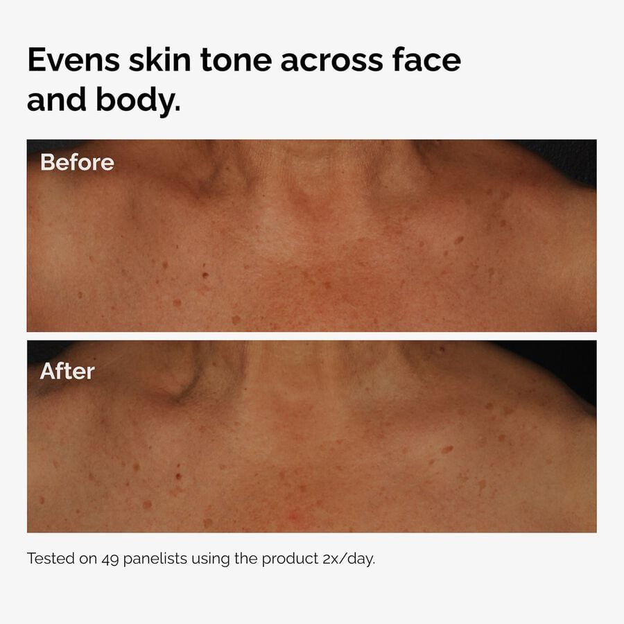 the-body-care-collection-z4 ord-niacinamide-face-body-serum-before-after-even-tone-graphic.jpg
