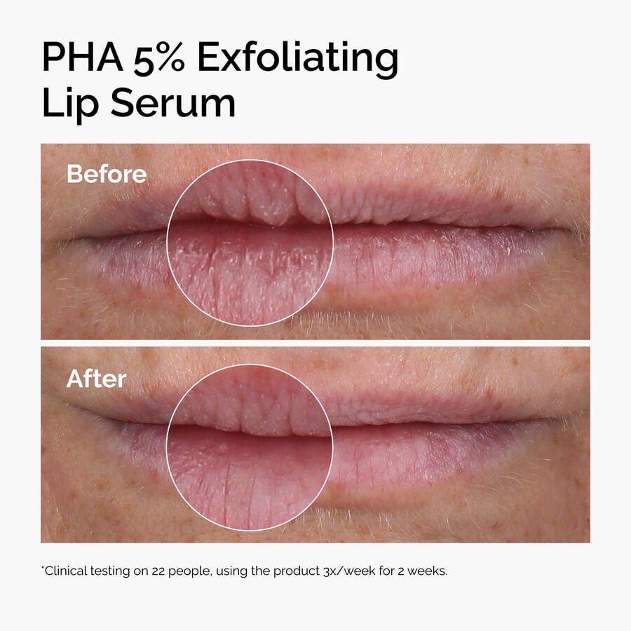 pha-5-exfoliating-lip-serum-p9 ord-pha-5pct-lip-exfoliating-serum-before-after.jpg