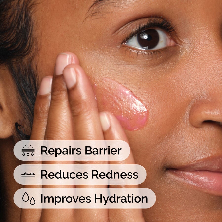 soothing-and-barrier-support-serum-set-g0 ord-soothing-barrier-support-serum-model-application-with-benefits.jpg